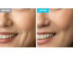 CHARDE Cloud Ampoule Kit - Image 6