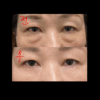 melable U-Therable Lifting 900 Shot Eye Cream 15ml
