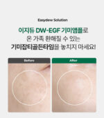Easydew DW-EGF Melatoning One-Day Ampoule 10ml - Image 3