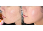 Pira Real Collagen Cheek Pack 1box - Image 2