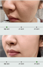 mommy care Sea Grape Pore Lifting Ampoule 80ml - Image 2