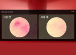 Anua Heartleaf Centella Red Spot Cream 30g - Image 2