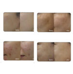 AuLabs Toning Activator 10ml*4ea - Image 2