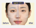 CKD Vitamin C Freckles Blemish Shot Mask 34g*5pack - Image 3