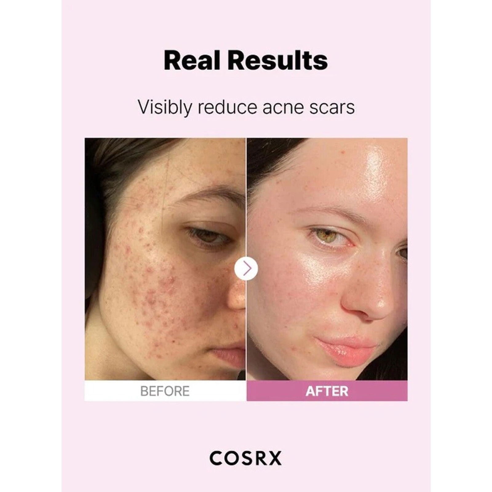 COSRX The Niacinamide 15 Serum 20mL - EmpressKorea