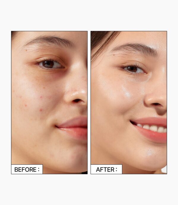 Parnell  Cicamanu 92 Serum 30ml - EmpressKorea
