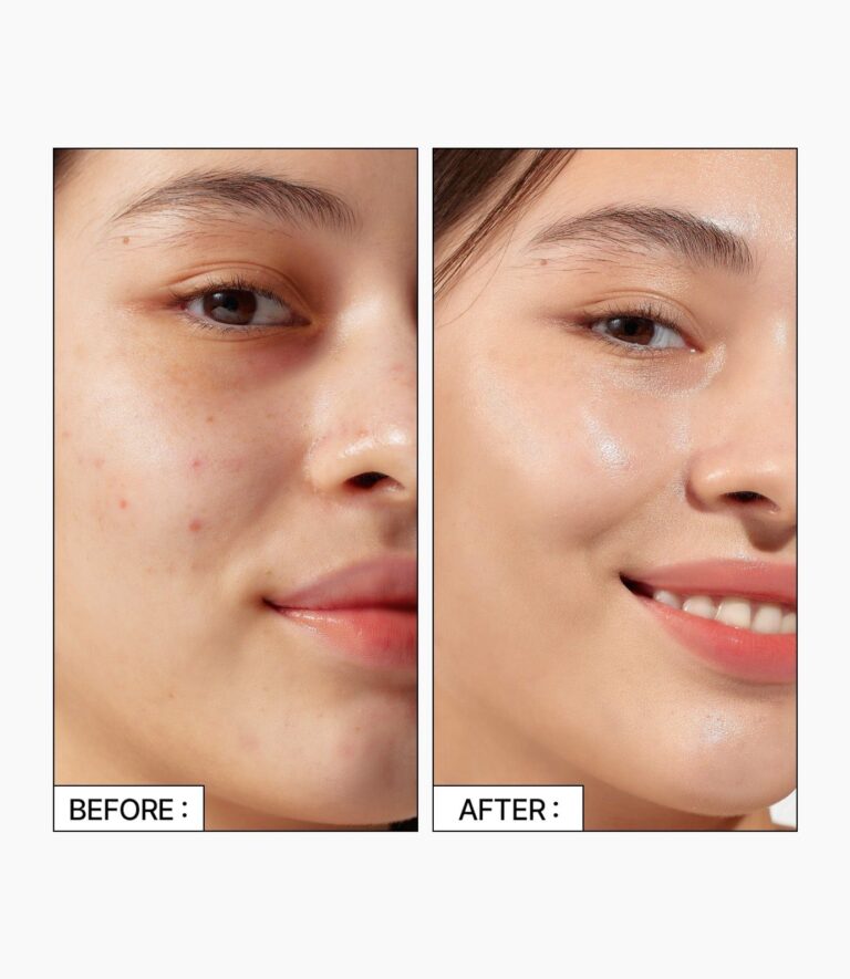 Parnell  Cicamanu 92 Serum 30ml - EmpressKorea