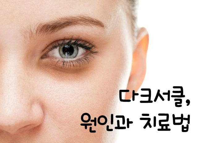 The Main Causes of Dark Circles π by EmpressKorea