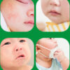 ATONO2 SOS Cream Around Mouth 20ml (100% Food Grade Ingredients!)