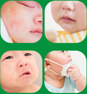 ATONO2 SOS Cream Around Mouth 20ml (100% Food Grade Ingredients!)