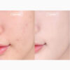 ABOUT TONE Skin Layer Fit Foundation 30ml SPF30+ PA++