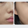 CELL IN SHOT TX Glutashot X 8Hyal Cicamide 50ml