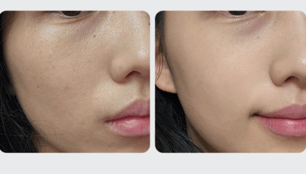CELL IN SHOT TX Glutashot X 8Hyal Cicamide 50ml
