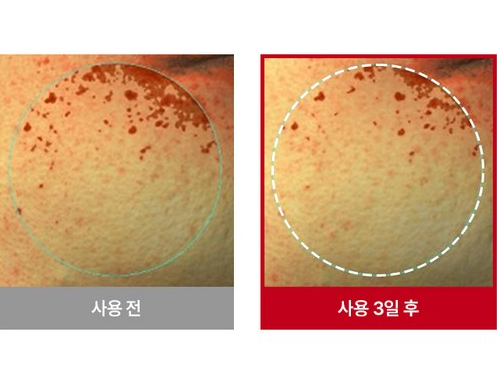 RAVIEL Acerola Dark Spot & Blemish Care Cream 80ml - Facial Milla/Flat Warts Improve
