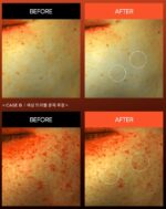 Dr.Melaxin Exosome Blemish Repair Cream 50ml - Image 5