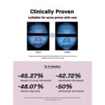COSRX The Niacinamide 15 Serum 20mL - Image 5
